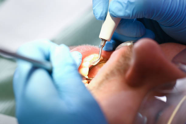 Best Broken Tooth Emergency  in Silver Lakes, CA