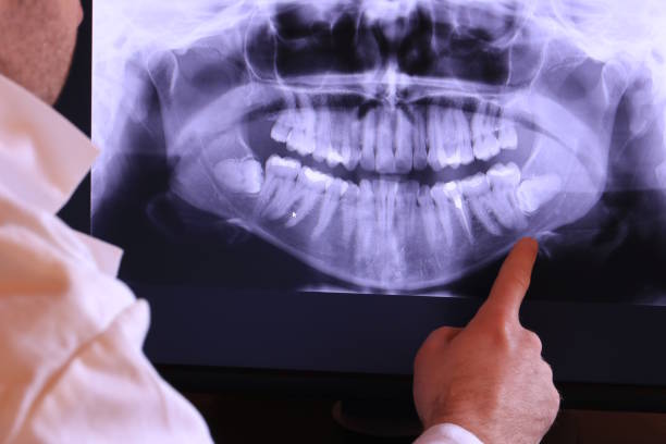 Best Emergency Dentist Near Me  in Silver Lakes, CA