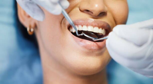 Best Emergency Dental Services Near Me  in Silver Lakes, CA