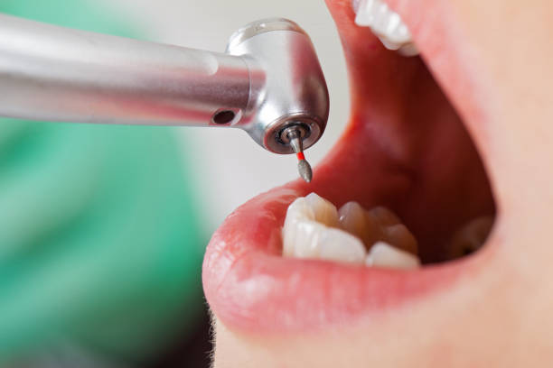 Best Tooth Infection Emergency Dentist  in Silver Lakes, CA